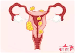 56岁供卵移植成功率_备孕指南 这些状态下别受孕